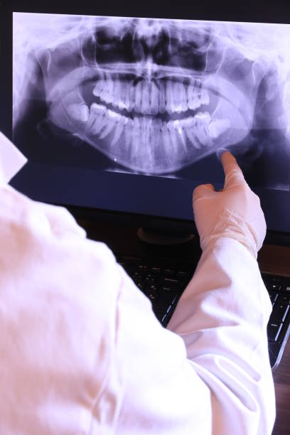 Best Emergency Root Canal Treatment in Mableton, GA